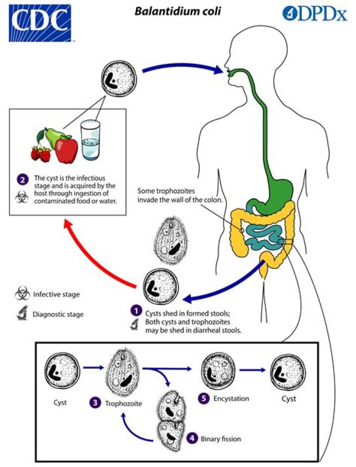What disease does balantidium coli cause?