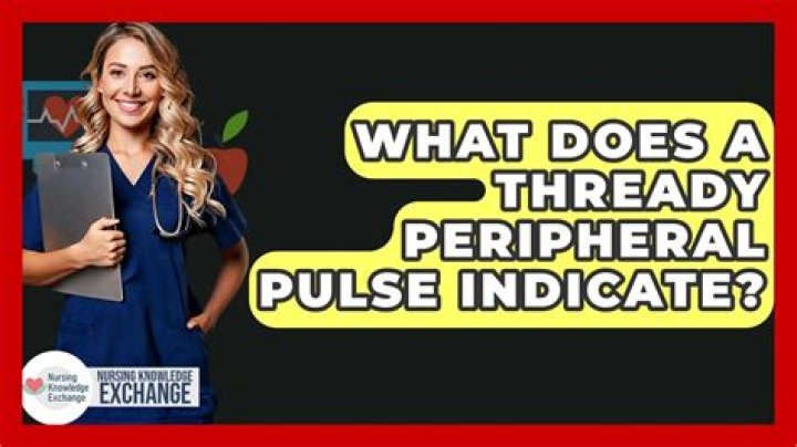 What does a thready pulse feel like?