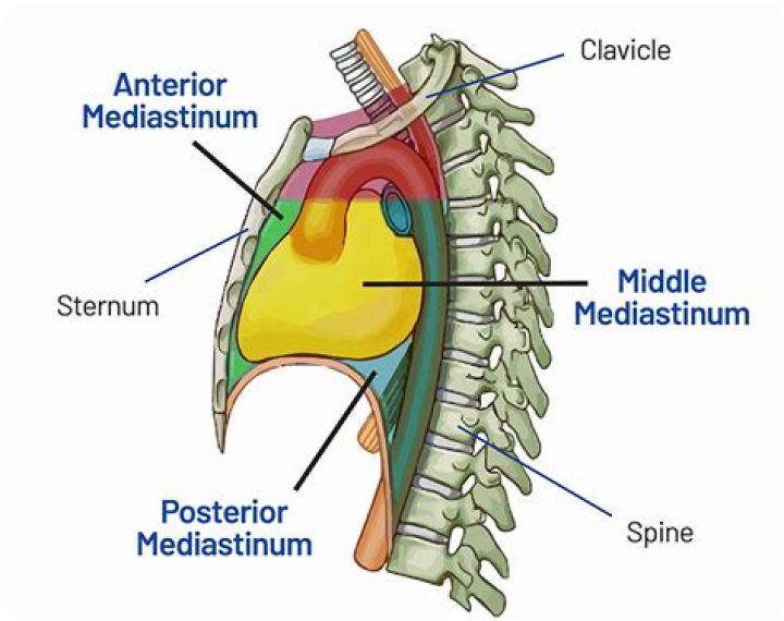 What does a widened mediastinum indicate?