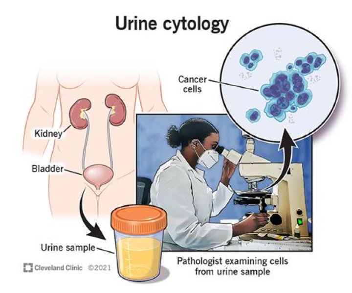 What does cytologist do?