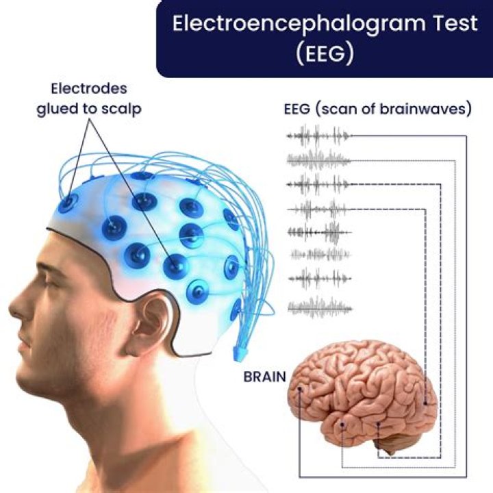 What does electroencephalogram mean?