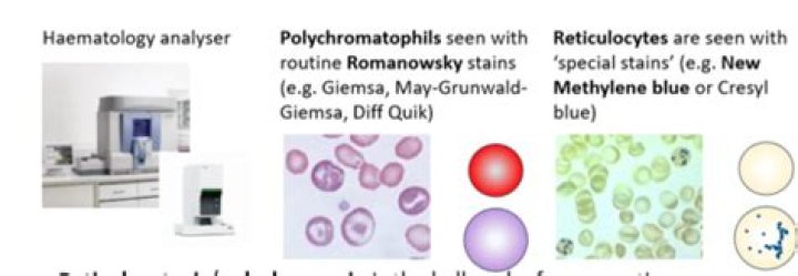 What does haematology mean?