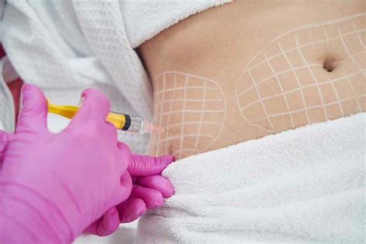 What does lipolysis do?