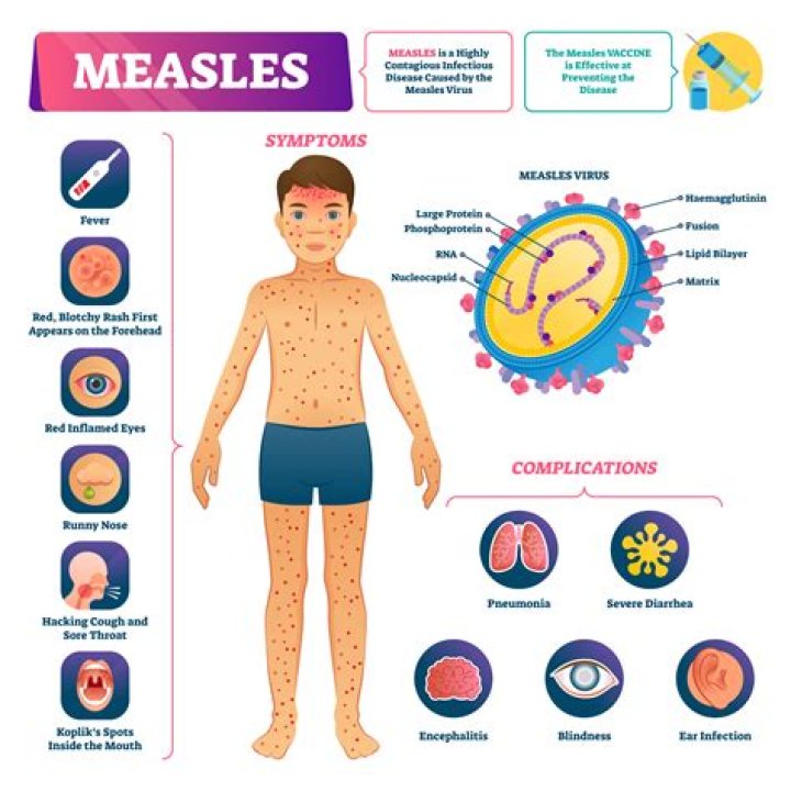 What does measles cause?