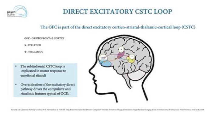 What does striatal toe mean?