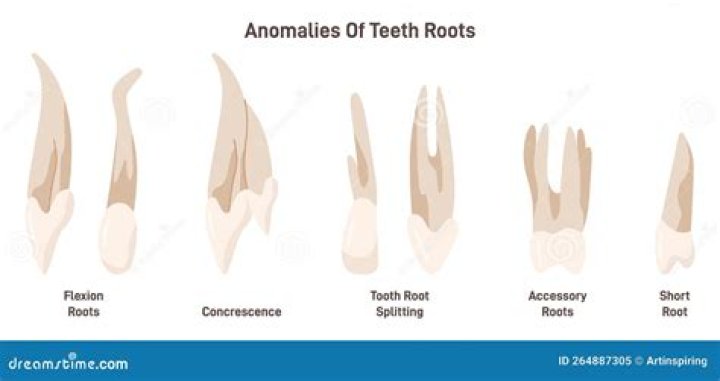 What does the root odont mean?