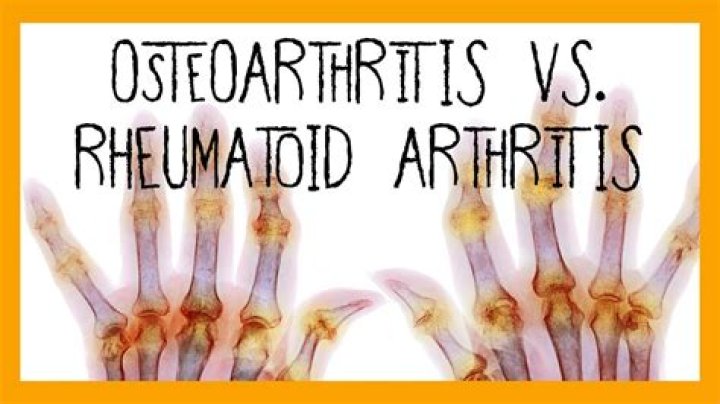 What does the word arthrosis mean?