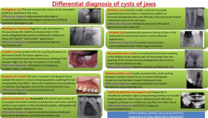 What does the word odontogenic means?