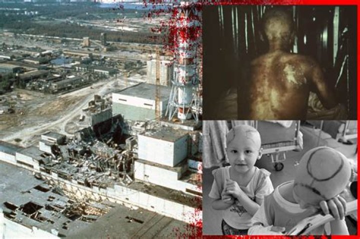 What happened to the firemen at chernobyl?