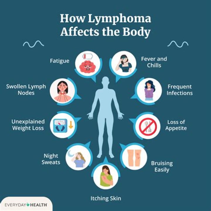 What happens when you have lymphoma cancer?