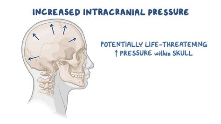 What increased intracranial pressure?