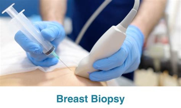 What is a breast board?