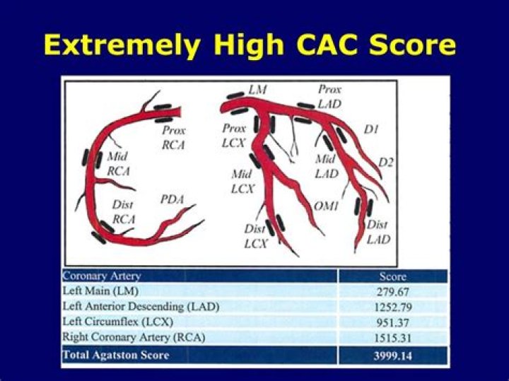 What is a cac test?
