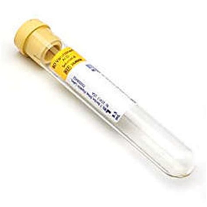 What is a heparinized tube?