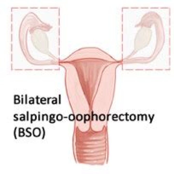 What is a laparoscopic bilateral salpingo oophorectomy?