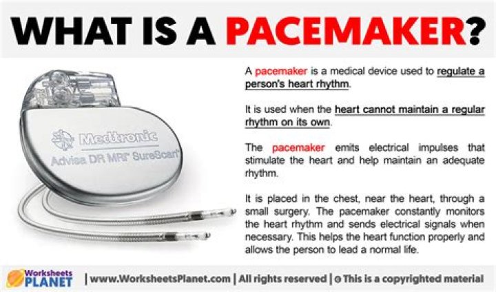 What is a pacemaker called?