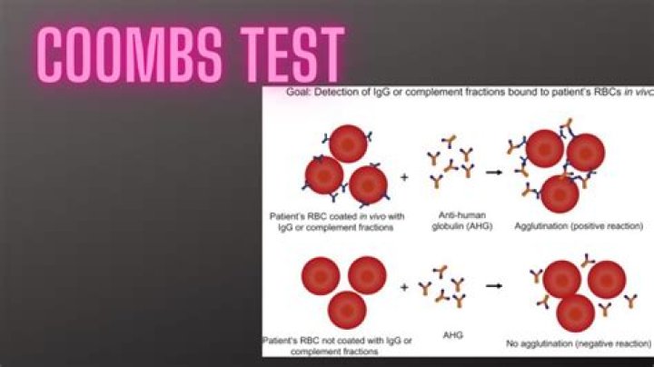 What is a positive indirect coombs test?