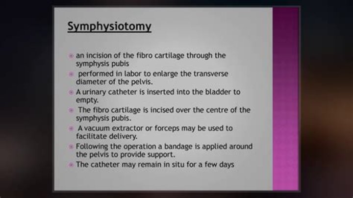What is a symphysiotomy operation?