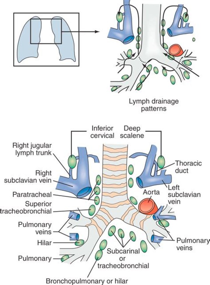 What is adenopathy mediastinal?