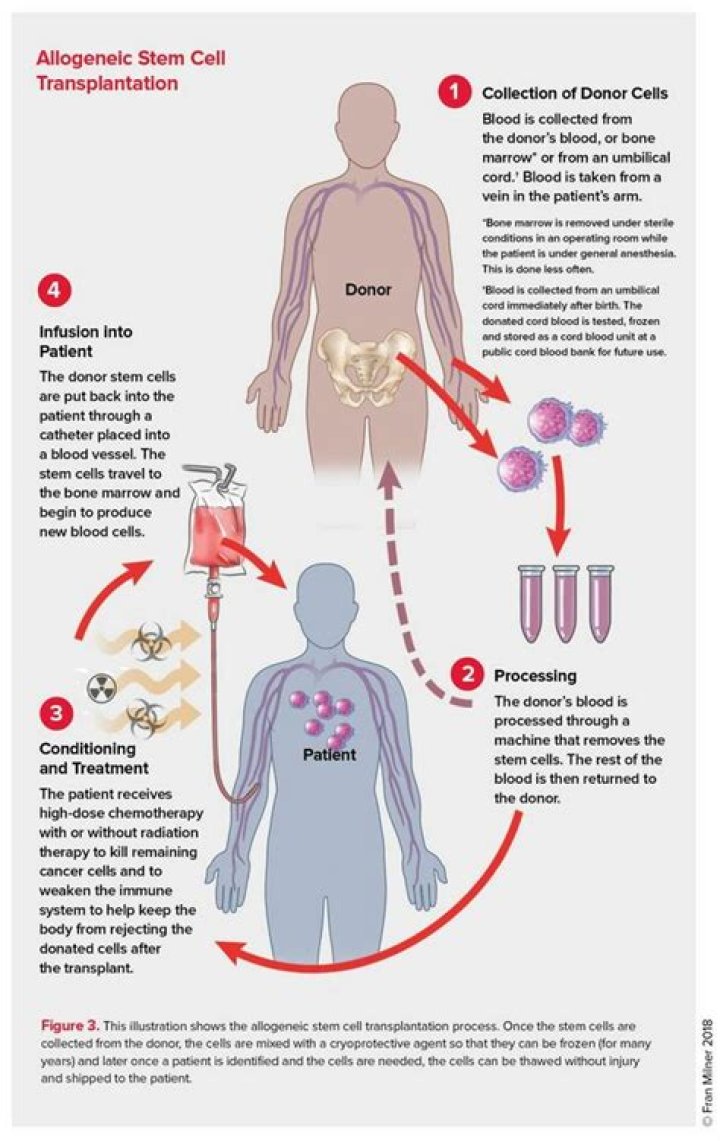 What is allogeneic hematopoietic stem cell transplantation?