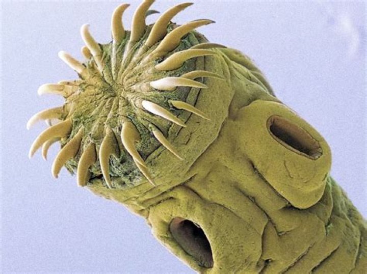 What is an encysted larva of the beef tapeworm called?