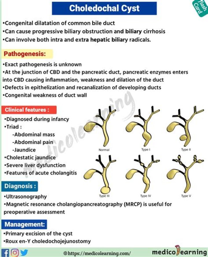 What is choledochal cyst?