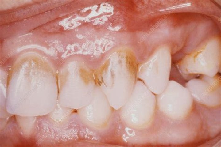 What is chromogenic bacteria?