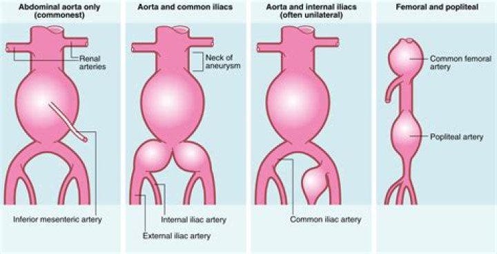 What is circinate ptyxis?