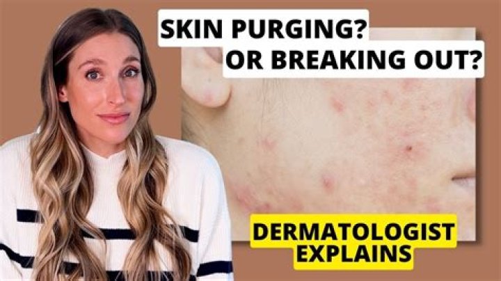 What is considered breaking the skin?