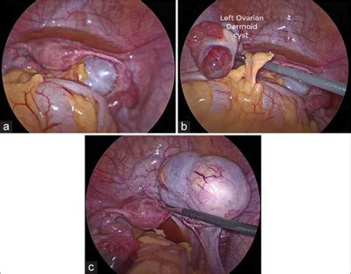 What is crenulated in english?