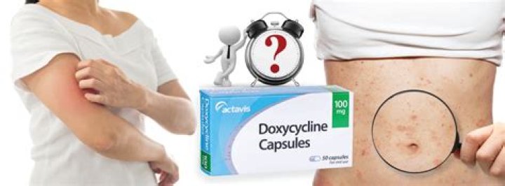 What is doxycycline used for?