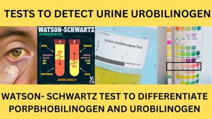 What is ehrlich test?