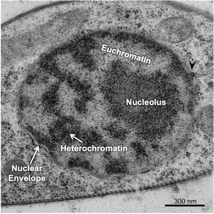 What is euchromatic nucleus?