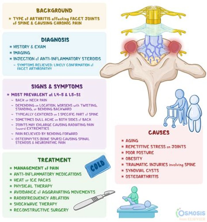 What is facet arthrosis?