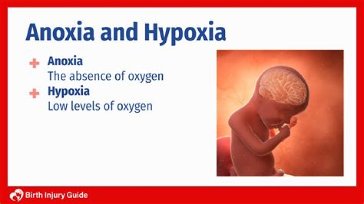What is fetal anoxia?