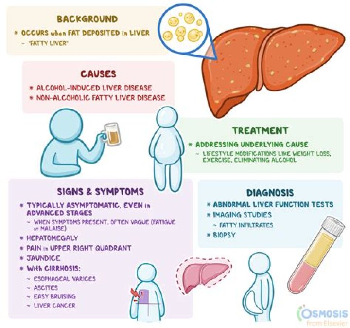 What is hepatic paragonimiasis?
