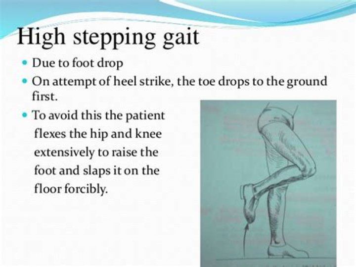 What is high stepping gait?