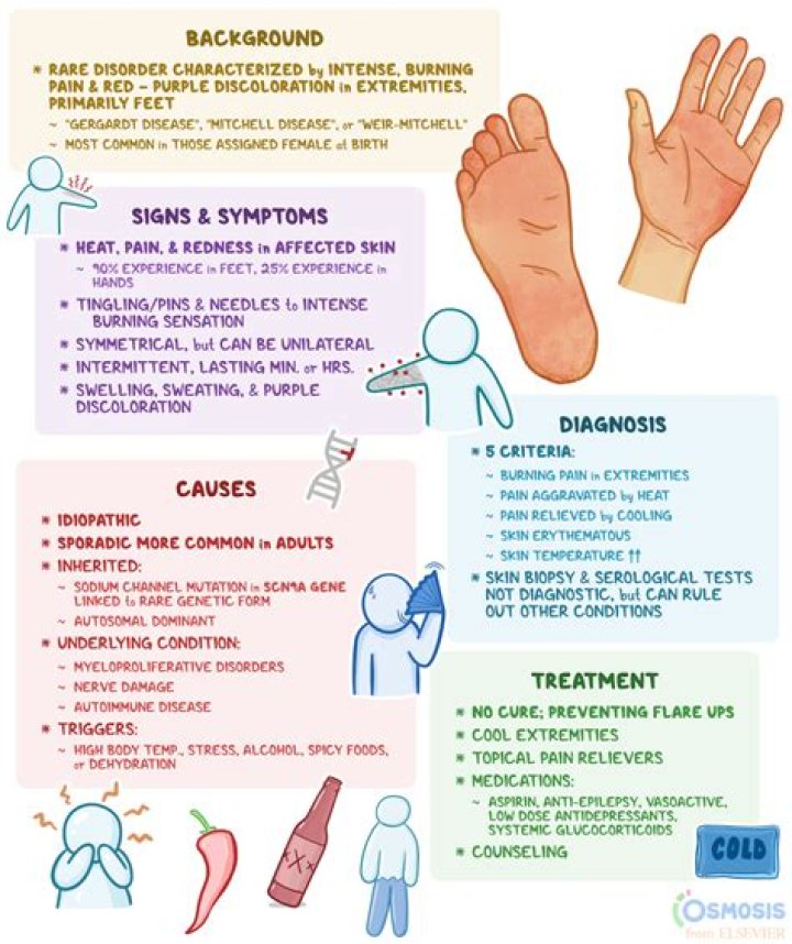 What is hot feet syndrome?