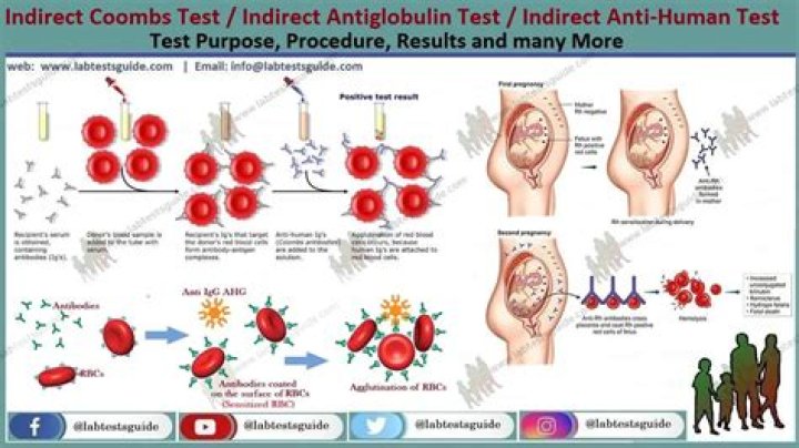 What is indirect coombs test in pregnancy?