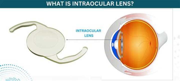 What is interocular transfer?