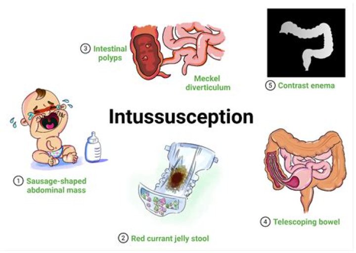 What is intussusception in biology?