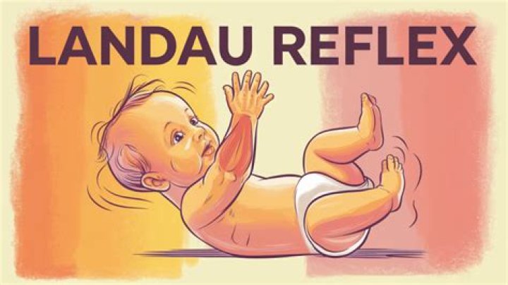 What is landau reflex?