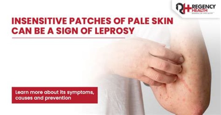 What is meant by leprotic?