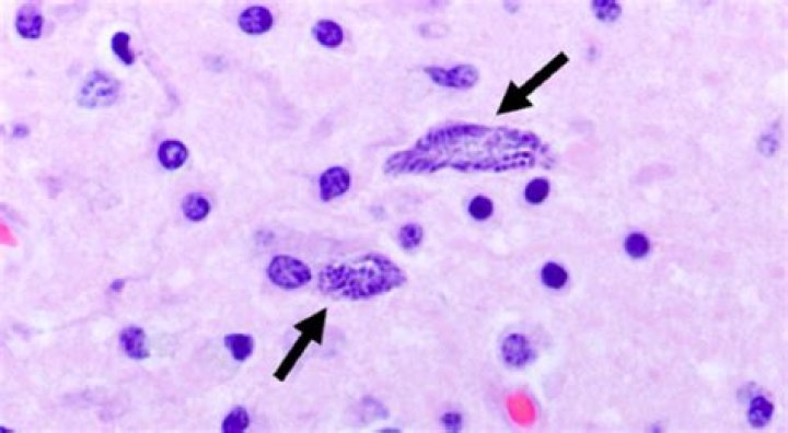 What is protozoal myeloencephalitis?