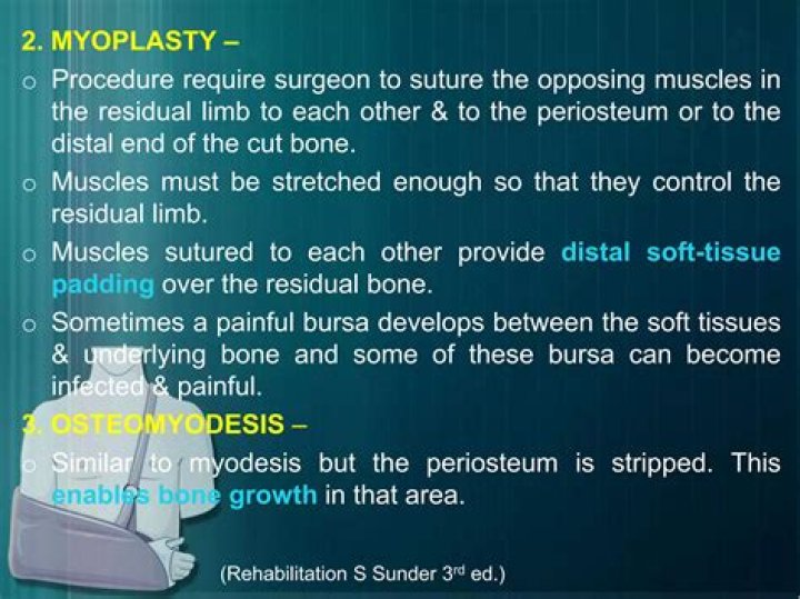 What is the meaning of the medical term myoplasty?