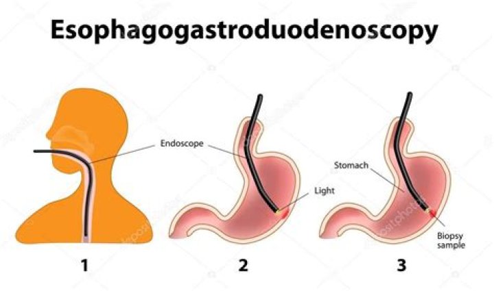 What is the medical term for esophagogastroscopy?
