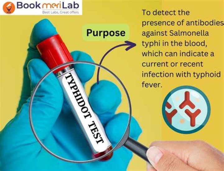 What is the purpose of ppcs?