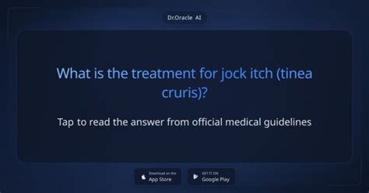 What is the treatment for jock itch?