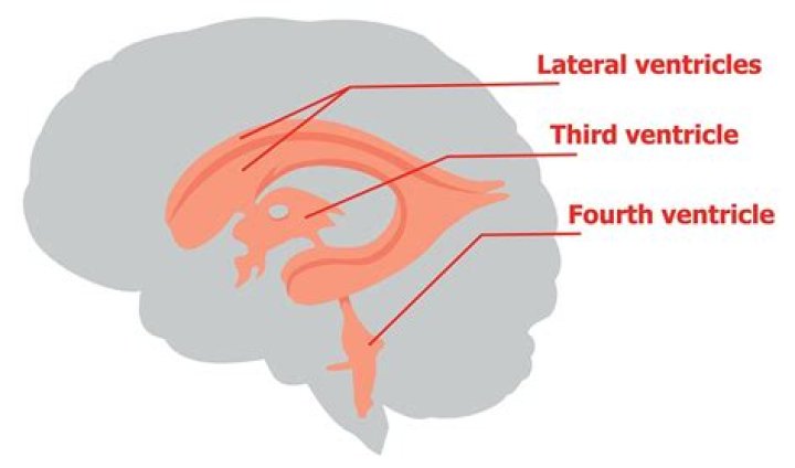 What is ventricle size?
