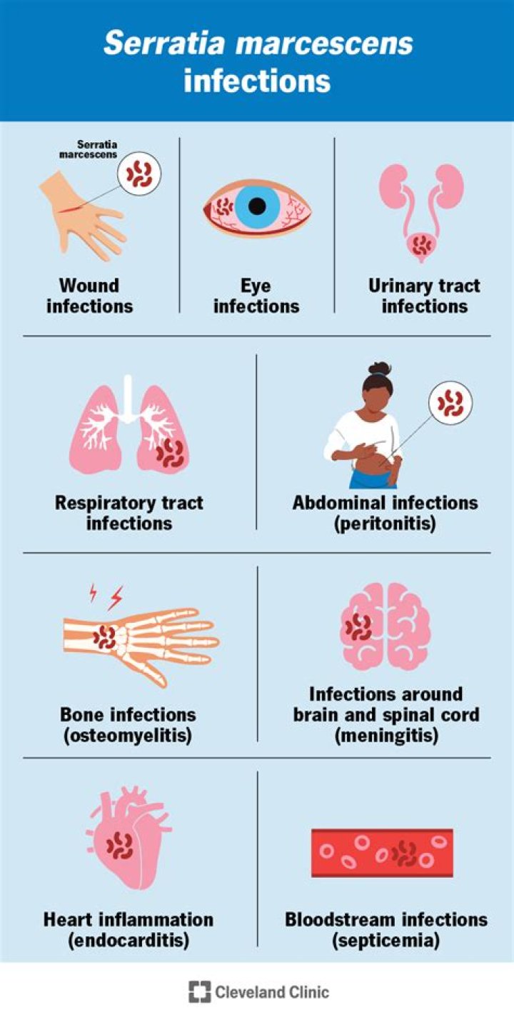 What kills serratia marcescens?